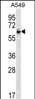 Rabbit Polyclonal Antibody to ZNF417