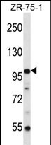 Rabbit Polyclonal Antibody to ZNF845 (N-term)