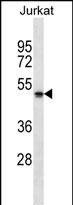 Rabbit Polyclonal Antibody to NBPF5