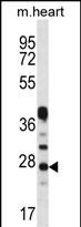 Rabbit Polyclonal Antibody to CRYBA1