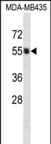 Rabbit Polyclonal Antibody to PIGA