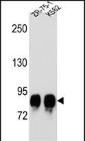 Rabbit Polyclonal Antibody to POMT1