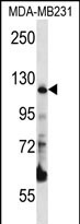 Rabbit Polyclonal Antibody to PITRM1