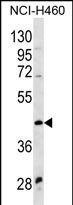 Rabbit Polyclonal Antibody to WNT9A