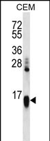 Rabbit Polyclonal Antibody to HIST1H2AA (N-term)