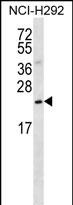 Rabbit Polyclonal Antibody to SLMO2