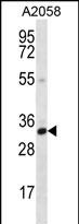 Rabbit Polyclonal Antibody to CNN2 (N-term)