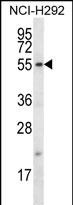 Rabbit Polyclonal Antibody to FBXO15 (N-term)