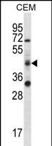 Rabbit Polyclonal Antibody to RBM42