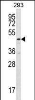 Rabbit Polyclonal Antibody to TBCEL
