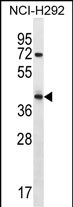 Rabbit Polyclonal Antibody to ARRDC5 (N-term)