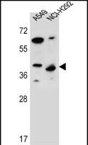 Rabbit Polyclonal Antibody to LRRC67