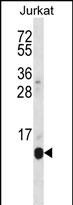 Rabbit Polyclonal Antibody to POLR2G