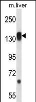 Rabbit Polyclonal Antibody to RPS6KC1 (N-term)