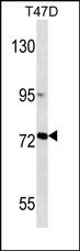 Mouse Monoclonal Antibody to MMP2