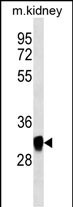 Mouse Monoclonal Antibody to GNPDA1