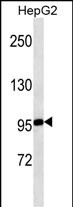 Mouse Monoclonal Antibody to MASTL