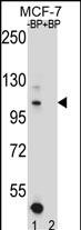 Rabbit Polyclonal Antibody to HIPK1