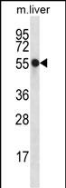 Rabbit Polyclonal Antibody to NXN