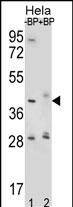 Rabbit Polyclonal Antibody to HYAL2