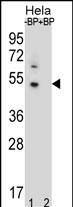 Rabbit Polyclonal Antibody to DNAJB6