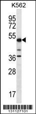 Rabbit Polyclonal Antibody to PSTPIP1 (N-term)