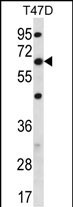Rabbit Polyclonal Antibody to FA83D