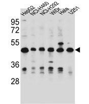 Rabbit Polyclonal Antibody to DUS1L