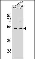 Rabbit Polyclonal Antibody to WDR86