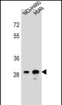 Rabbit Polyclonal Antibody to DHRS4L1