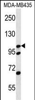 Rabbit Polyclonal Antibody to CTNND2
