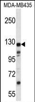 Rabbit Polyclonal Antibody to K1324