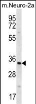 Rabbit Polyclonal Antibody to PEX14