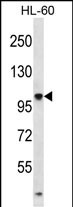 Rabbit Polyclonal Antibody to TTLL4