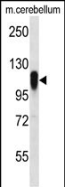 Rabbit Polyclonal Antibody to FBX41 (N-term)