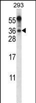 Rabbit Polyclonal Antibody to BEND6