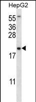 Rabbit Polyclonal Antibody to UBE2NL (N-term)