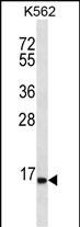 Rabbit Polyclonal Antibody to SPINK8
