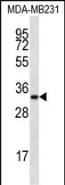 Rabbit Polyclonal Antibody to LIX1L
