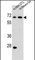 Rabbit Polyclonal Antibody to ME2
