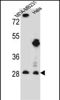 Rabbit Polyclonal Antibody to EIF4H