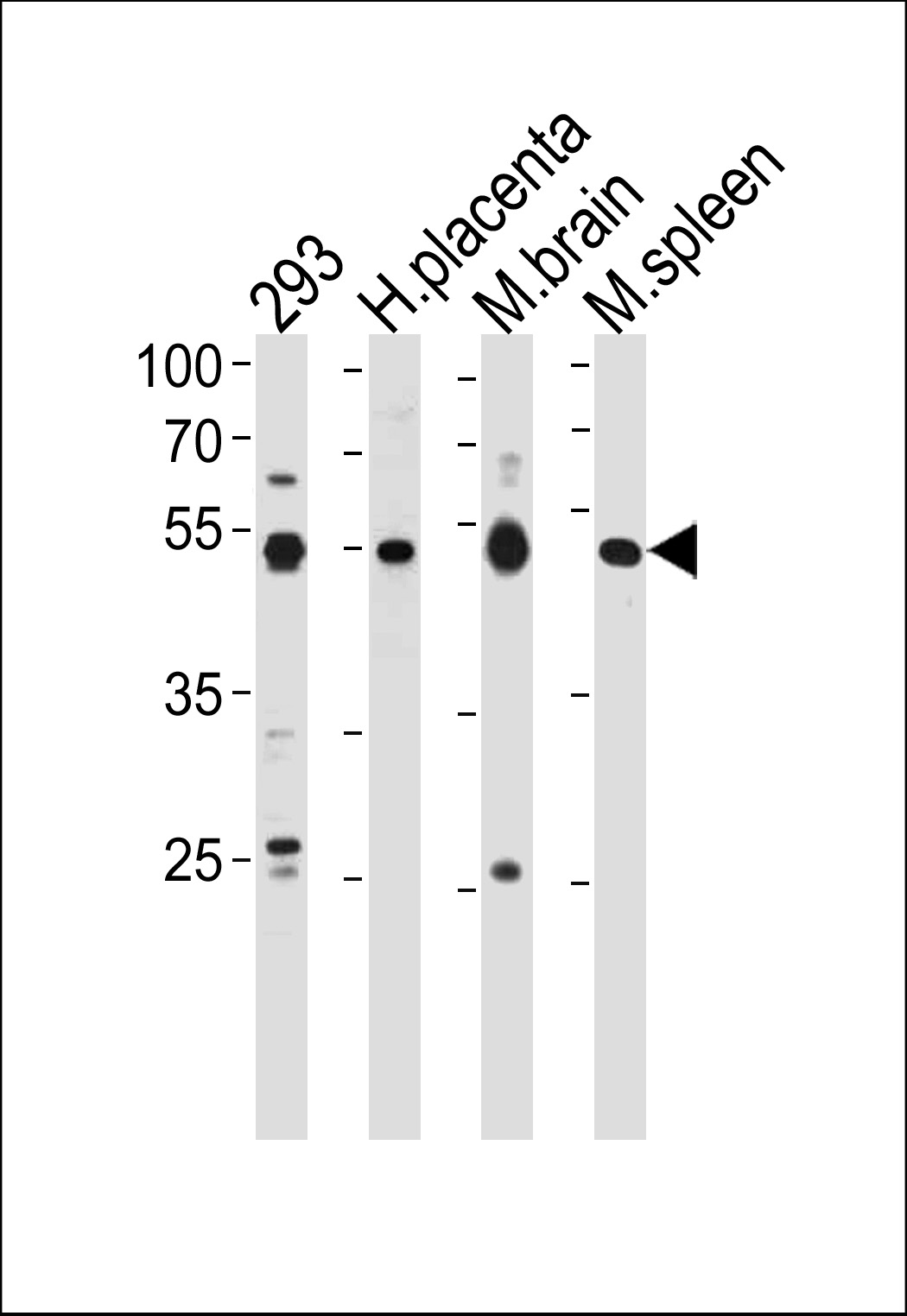 Rabbit Polyclonal Antibody to HINFP
