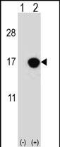 Rabbit Polyclonal Antibody to CDKN2B