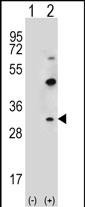 Rabbit Polyclonal Antibody to CLDN2 (C-term Y195)