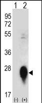 Rabbit Polyclonal Antibody to CLEC3B