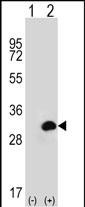 Rabbit Polyclonal Antibody to CA1 (N-term)