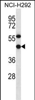 Rabbit Polyclonal Antibody to EBNA1BP2