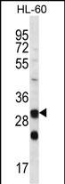 Rabbit Polyclonal Antibody to CA6