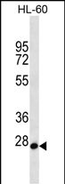 Rabbit Polyclonal Antibody to MED22 (N-term)