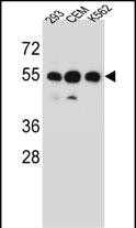 Rabbit Polyclonal Antibody to ZNF562 (N-term)